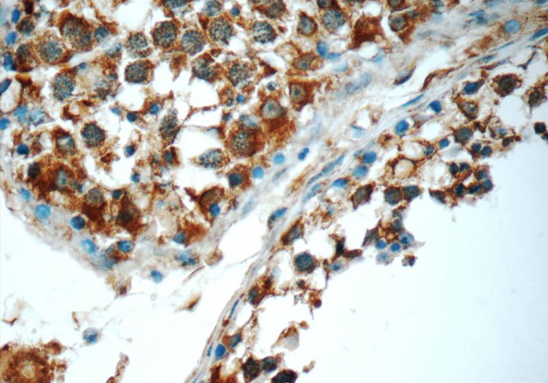 Immunohistochemistry of paraffin-embedded human testis tissue slide using Catalog No:116177(TMEM213 Antibody) at dilution of 1:50 (under 40x lens)