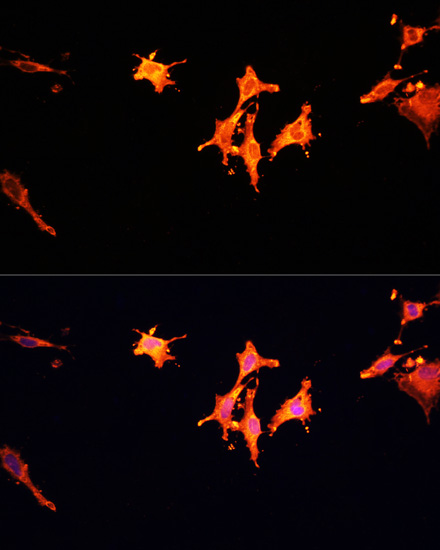 Immunofluorescence - MST1 Polyclonal Antibody 