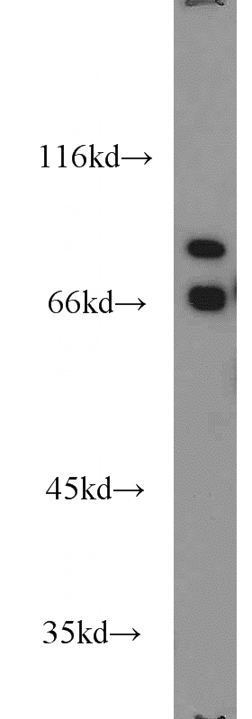 mouse liver tissue were subjected to SDS PAGE followed by western blot with Catalog No:107674(APEH antibody) at dilution of 1:1000