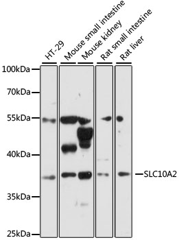 Western blot - SLC10A2 Polyclonal Antibody 