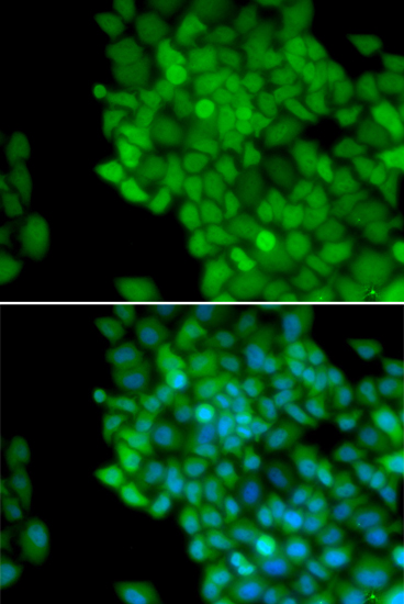 Immunofluorescence - MAGEA1 Polyclonal Antibody 