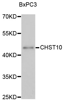 Western blot - CHST10 Polyclonal Antibody 