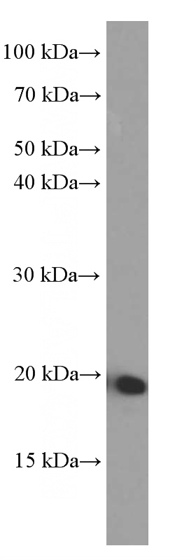 Recombinant protein were subjected to SDS PAGE followed by western blot with Catalog No:107386(IL19 Antibody) at dilution of 1:10000
