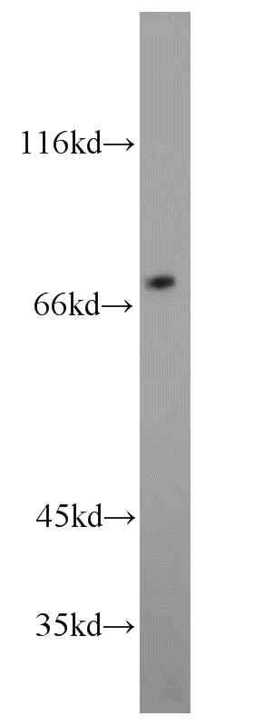 A431 cells were subjected to SDS PAGE followed by western blot with Catalog No:112905(MVD antibody) at dilution of 1:800
