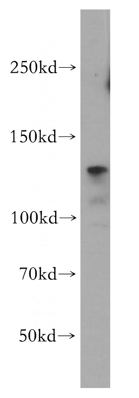 HeLa cells were subjected to SDS PAGE followed by western blot with Catalog No:111862(ITGB1 antibody) at dilution of 1:300