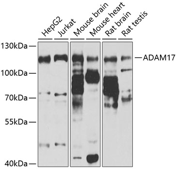 Western blot - ADAM17 Polyclonal Antibody 