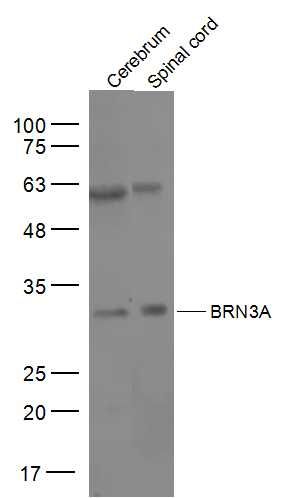 Fig1: Sample:; Cerebrum (Mouse) Lysate at 40 ug; Spinal cord (Mouse) Lysate at 40 ug; Primary: Anti-BRN3A at 1/500 dilution; Secondary: IRDye800CW Goat Anti-Rabbit IgG at 1/20000 dilution; Predicted band size: 43 kD; Observed band size: 33 kD