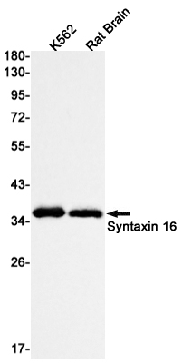 Western blot detection of Syntaxin 16 in K562,Rat Brain lysates using Syntaxin 16 Rabbit mAb(1:1000 diluted).Predicted band size:37kDa.Observed band size:37kDa.