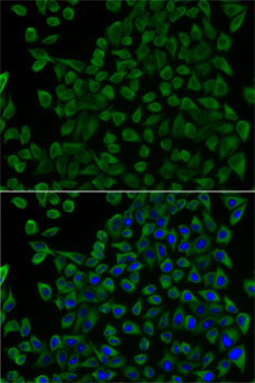 Immunofluorescence - TCN2 Polyclonal Antibody 