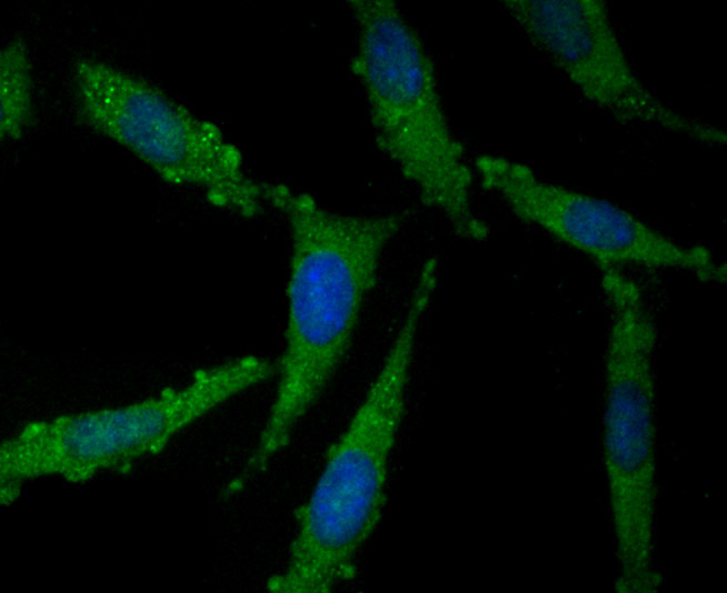 Fig2: ICC staining NLRC3 in SH-SY5Y cells (green). The nuclear counter stain is DAPI (blue). Cells were fixed in paraformaldehyde, permeabilised with 0.25% Triton X100/PBS.