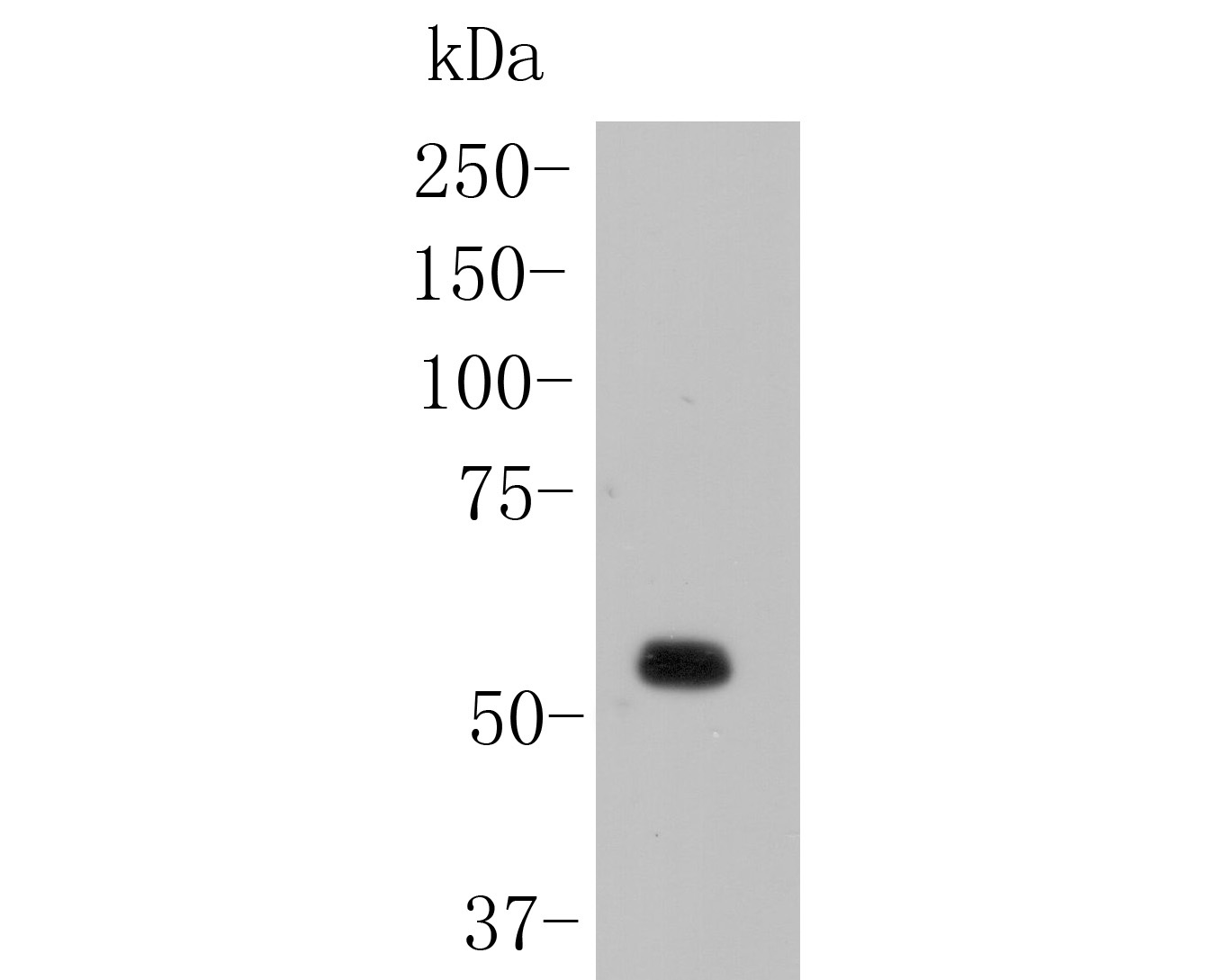 Fig1:; Western blot analysis of NHE-1 on rat skin lysates. Proteins were transferred to a PVDF membrane and blocked with 5% BSA in PBS for 1 hour at room temperature. The primary antibody ( 1/1000) was used in 5% BSA at room temperature for 2 hours. Goat Anti-Rabbit IgG - HRP Secondary Antibody (HA1001) at 1:5,000 dilution was used for 1 hour at room temperature.