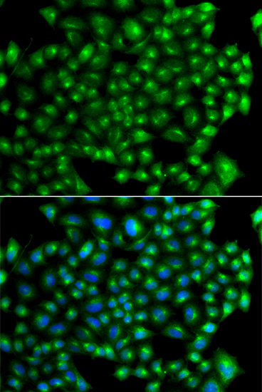 Immunofluorescence - ZFYVE1 Polyclonal Antibody 