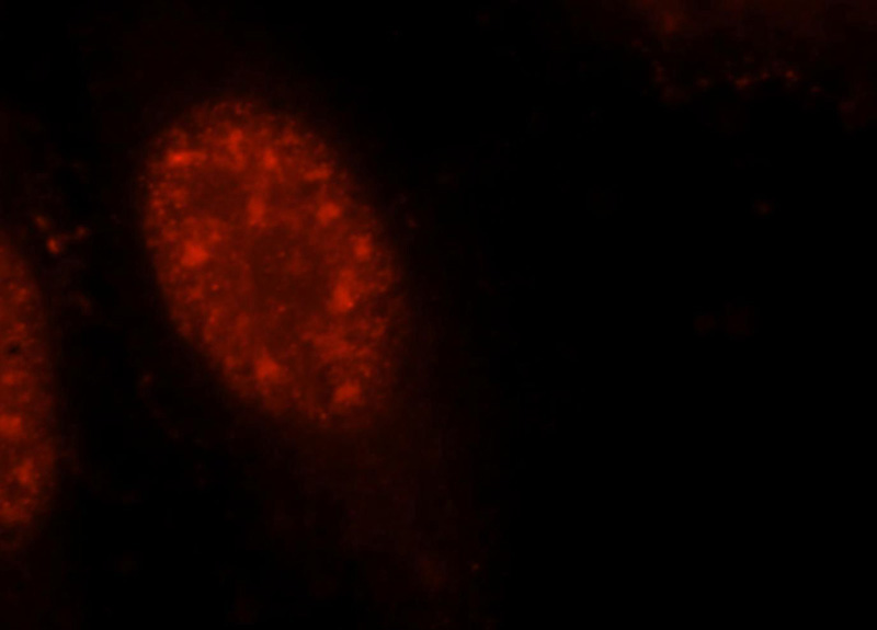 Immunofluorescent analysis of Hela cells, using UBE3A antibody Catalog No:116541 at 1:25 dilution and Rhodamine-labeled goat anti-rabbit IgG (red).
