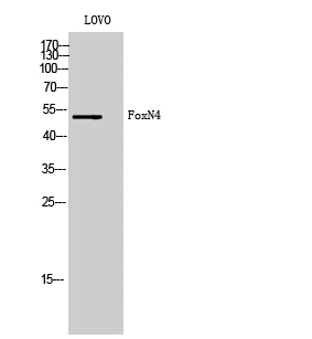 Fig1:; Western Blot analysis of LOVO cells using FoxN4 Polyclonal Antibody cells nucleus extracted by Minute TM Cytoplasmic and Nuclear Fractionation kit (SC-003,Inventbiotech,MN,USA).