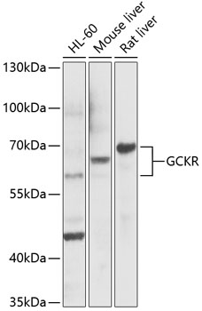 Western blot - GCKR Polyclonal Antibody 