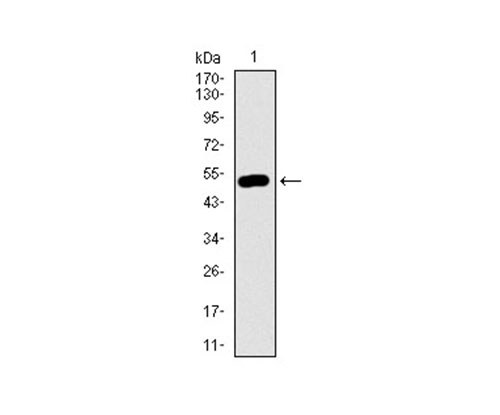 Fig1: Western blot analysis of DCTN4 on human DCTN4 recombinant protein using anti-DCTN4 antibody at 1/1,000 dilution.