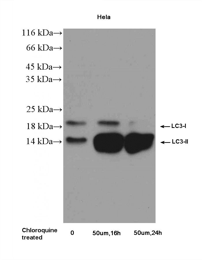 Chloroquine treated HeLa cells were subjected to SDS PAGE followed by western blot with Catalog No:112163 (LC3 Antibody) at dilution of 1:1000