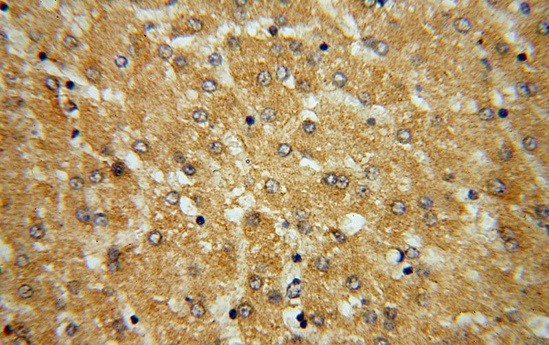 Immunohistochemical of paraffin-embedded human liver using Catalog No:110611(FDXR antibody) at dilution of 1:100 (under 40x lens)