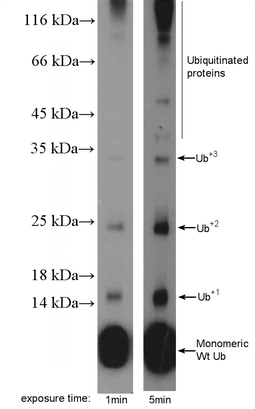 MDA-MB-453s cells were subjected to SDS PAGE followed by western blot with Catalog No:116649(ubiquitin Antibody) at dilution of 1:600