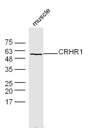 Fig3: Sample: muscle (mouse) Lysate at 40 ug; Primary: Anti-CRHR1 at 1/300 dilution; Secondary: IRDye800CW Goat Anti-Rabbit IgG at 1/20000 dilution; Predicted band size: 48 kD; Observed band size: 58 kD
