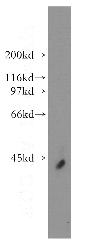 human cerebellum tissue were subjected to SDS PAGE followed by western blot with Catalog No:111717(ELAVL4 antibody) at dilution of 1:800