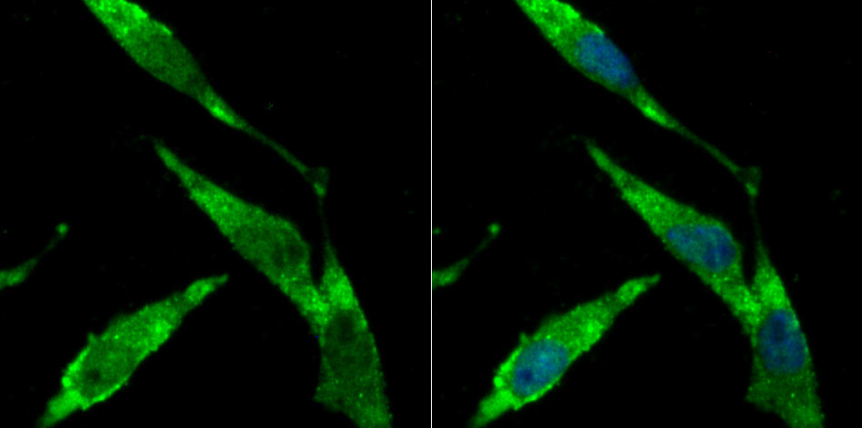 Fig3: ICC staining BHLHB9 in SH-SY-5Y cells (green). The nuclear counter stain is DAPI (blue). Cells were fixed in paraformaldehyde, permeabilised with 0.25% Triton X100/PBS.