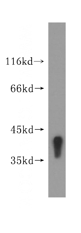 human liver tissue were subjected to SDS PAGE followed by western blot with Catalog No:116219(TPST2 antibody) at dilution of 1:500