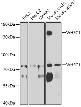 Western blot - WHSC1 Polyclonal Antibody 