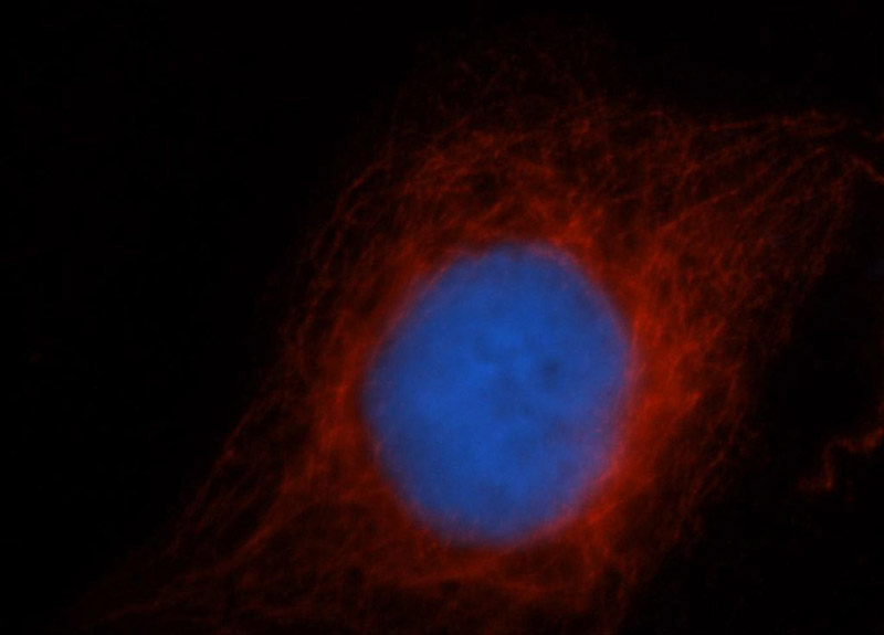 Immunofluorescent analysis of HepG2 cells, using CDC6 antibody Catalog No:109111 at 1:50 and Rhodamine-labeled goat anti-rabbit IgG (red). Blue pseudocolor = DAPI (fluorescent DNA dye).