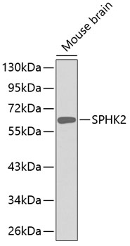 Western blot - SPHK2 Polyclonal Antibody 
