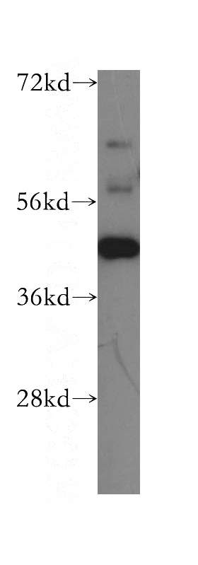 Jurkat cells were subjected to SDS PAGE followed by western blot with Catalog No:116581(USF2 antibody) at dilution of 1:1000