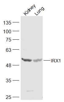 Fig2: Sample:; Kidney (Mouse) Lysate at 40 ug; Lung (Mouse) Lysate at 40 ug; Primary: Anti-IRX1 at 1/300 dilution; Secondary: IRDye800CW Goat Anti-Rabbit IgG at 1/20000 dilution; Predicted band size: 50 kD; Observed band size: 50 kD