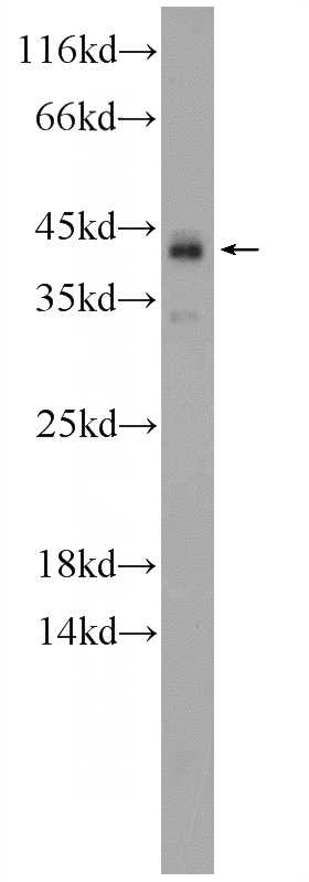 fetal human brain tissue were subjected to SDS PAGE followed by western blot with Catalog No:112042(KIAA0087 Antibody) at dilution of 1:600