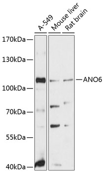 Western blot - ANO6 Polyclonal Antibody 