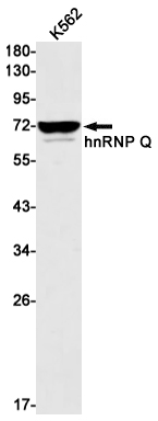 Western blot detection of hnRNP Q in K562 cell lysates using hnRNP Q Rabbit mAb(1:1000 diluted).Predicted band size:70kDa.Observed band size:70kDa.