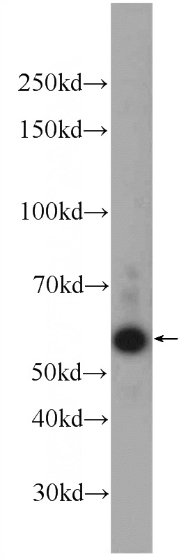 MCF-7 cells were subjected to SDS PAGE followed by western blot with Catalog No:116101(TMEM161A Antibody) at dilution of 1:1000
