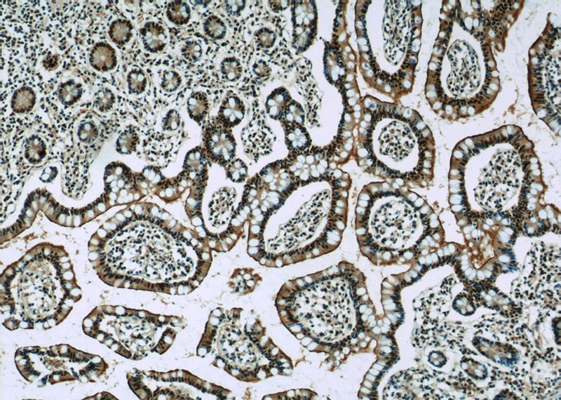 Immunohistochemistry of paraffin-embedded human small intestine slide using Catalog No:111059(GPBP1 Antibody) at dilution of 1:50