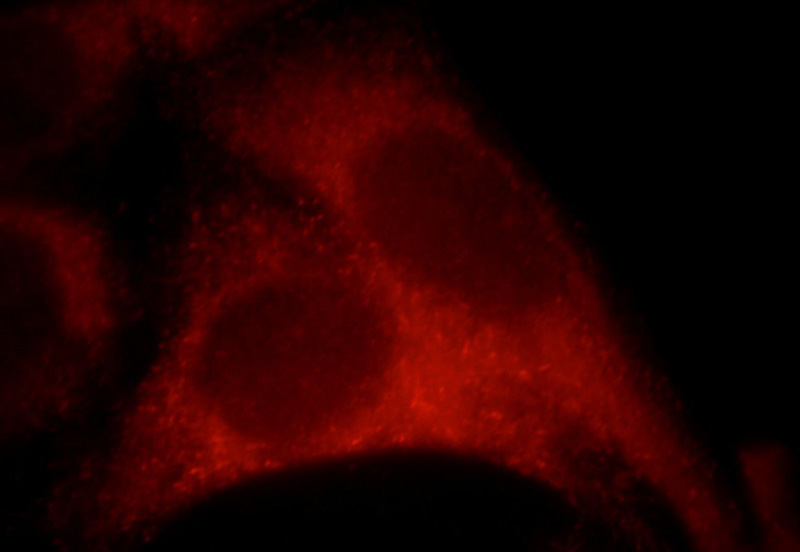 Immunofluorescent analysis of Hela cells, using SESN2 antibody Catalog No:115217 at 1:25 dilution and Rhodamine-labeled goat anti-rabbit IgG (red).