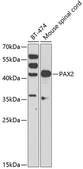 Western blot - PAX2 Polyclonal Antibody 
