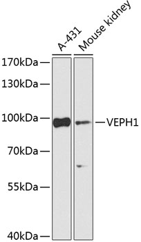 Western blot - VEPH1 Polyclonal Antibody 
