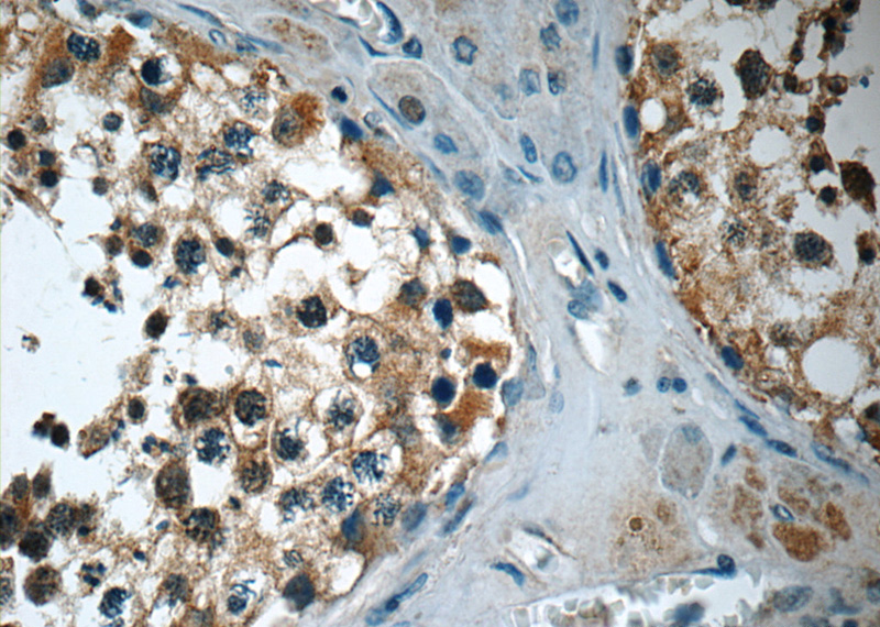 Immunohistochemistry of paraffin-embedded human testis tissue slide using Catalog No:115938(TEKT3 Antibody) at dilution of 1:50 (under 40x lens)