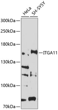 Western blot - ITGA11 Polyclonal Antibody 