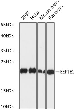 Western blot - EEF1E1 Polyclonal Antibody 