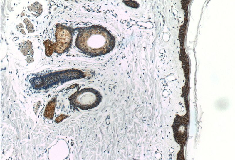 Immunohistochemistry of paraffin-embedded human skin tissue slide using Catalog No:112499(MAVS; VISA Antibody) at dilution of 1:200 (under 10x lens)