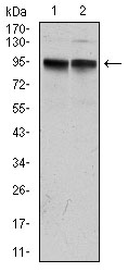 Western blot analysis using KCNQ1 mouse mAb against MCF-7 (1) and A431 (2) cell lysate.