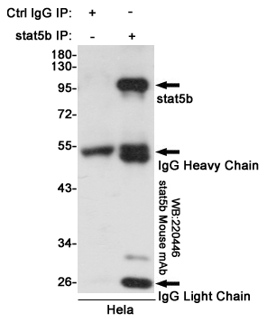 Immunoprecipitation analysis of Hela cell lysates using stat5b mouse mAb.