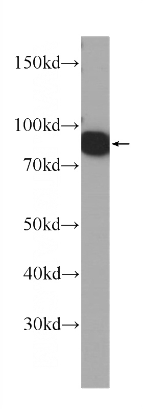RAW 264.7 cells were subjected to SDS PAGE followed by western blot with Catalog No:107538(VCP Antibody) at dilution of 1:1000