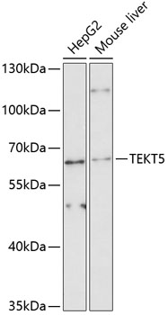 Western blot - TEKT5 Polyclonal Antibody 