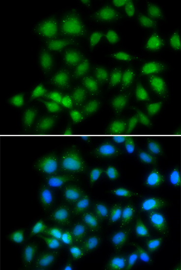 Immunofluorescence - MXI1 Polyclonal Antibody 