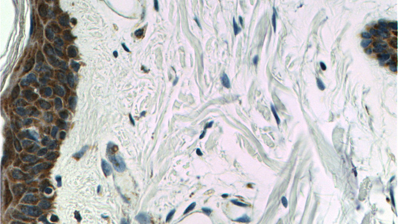 Immunohistochemistry of paraffin-embedded human skin tissue slide using Catalog No:112499(MAVS; VISA Antibody) at dilution of 1:200 (under 40x lens)